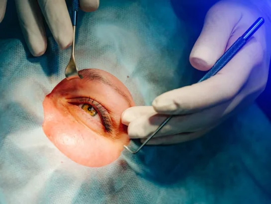 Oculoplasty & Reconstructive Surgery